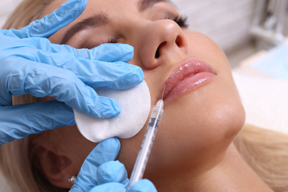 Restylane lip filler injection being administered at a med spa.